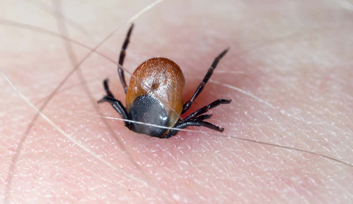 https://www.nhm.ac.uk/content/dam/nhm-www/discover/ticks/ticks-skin-biting-person-two-column-shutterstock.jpg